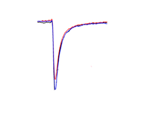 Primary cardiac m...